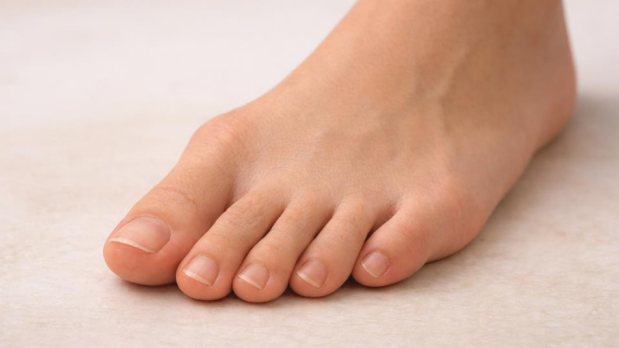 Early sign of bunion showing slight toe misalignment